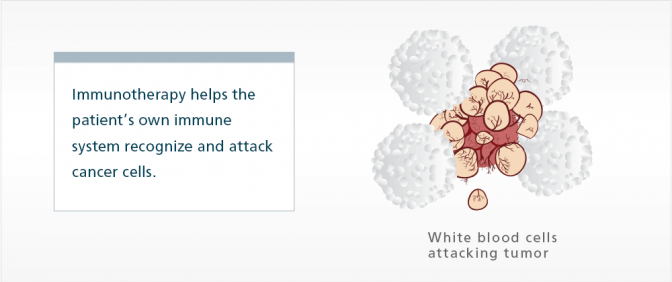 显示由于免疫疗法药物的帮助，显示白细胞的图表攻击肿瘤。