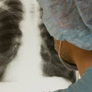 戴着面具的技师正在看肺部x光片