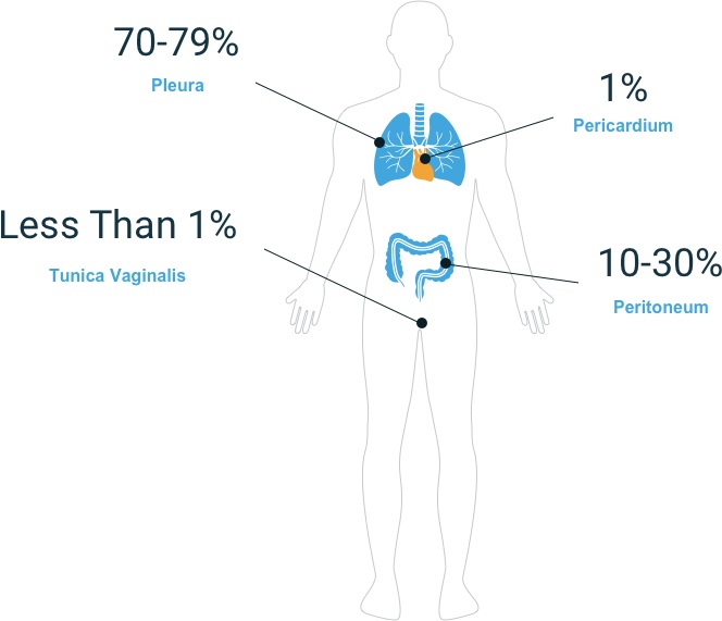 图示间皮瘤的类型占所有病例的百分比