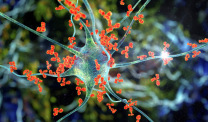 Antibodies attacking neuron